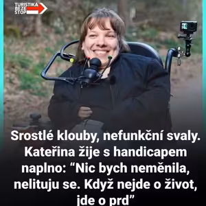 Srostlé klouby, nefunkční svaly. Kateřina žije s handicapem naplno: Nic bych neměnila. Když nejde o život, jde o prd