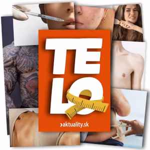 Cvičte ako Ronaldo, nie Schwarzenegger, radia odborníci