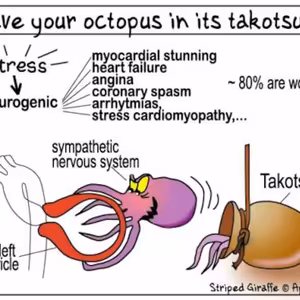 (KardioPodcast #3) Syndrom zlomeného srdce - Takotsubo kardiomyopatie