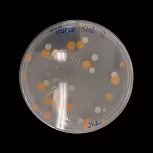 Oči dokorán pre správu a uchovávanie zbierok