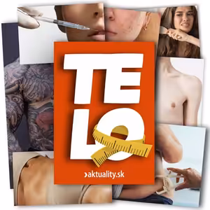 Umelé prsia nie sú tovar pre zľavový portál, hovorí plastický chirurg Imrich Kováč