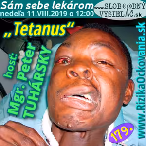 Sám sebe lekárom 179 - 2019-08-11 „Tetanus“