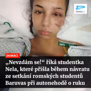 Čteme Romea.cz: „Nevzdám se!“ říká studentka Nela, které přišla během návratu ze setkání romských studentů Baruvas při autonehodě o ruku