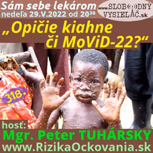 Sám sebe lekárom 318 - 2022-05-29 „Opičie kiahne či MoViD-22 ?“