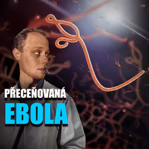 Šíření eboly v Africe je významné, ale ne apokalyptické
