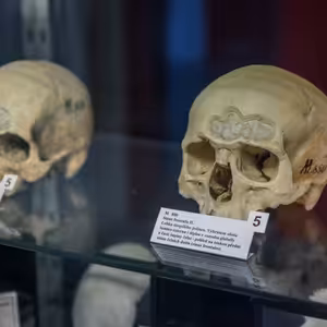 Anatomické muzeum Profesora Karla Žlábka, MUNI