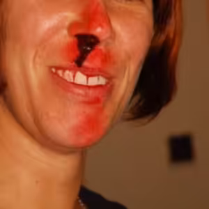 Mýty o první pomoci: Při krvácení z nosu zaklonit hlavu? (Veronika Cingelová, PrPom)