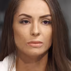 Byla popálená na 35 % těla: Byl to osud, léčba byla bolestivá, ale jizvy jsou jen vada na kráse, říká youtuberka Třešňáková