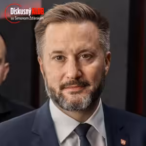 Primátor Bratislavy Vallo: Ráž je iba prostriedok, aby sa Smer dostal k moci v Bratislave!