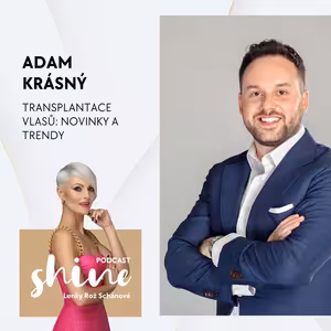 Adam Krásný: Jsme nejplešatější národ na světě. 90% tvoří genetika, 10% životní styl. Kdy má smysl jít na transplantaci vlasů?